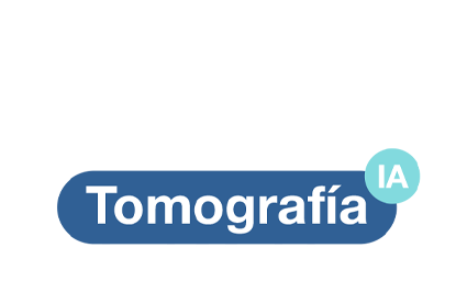 Tomografía Espiral Multicorte