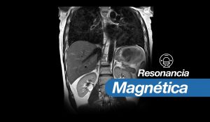 diagnóstico por imágenes médicas y resonancia magnética RMN en San Isidro lima perú image3